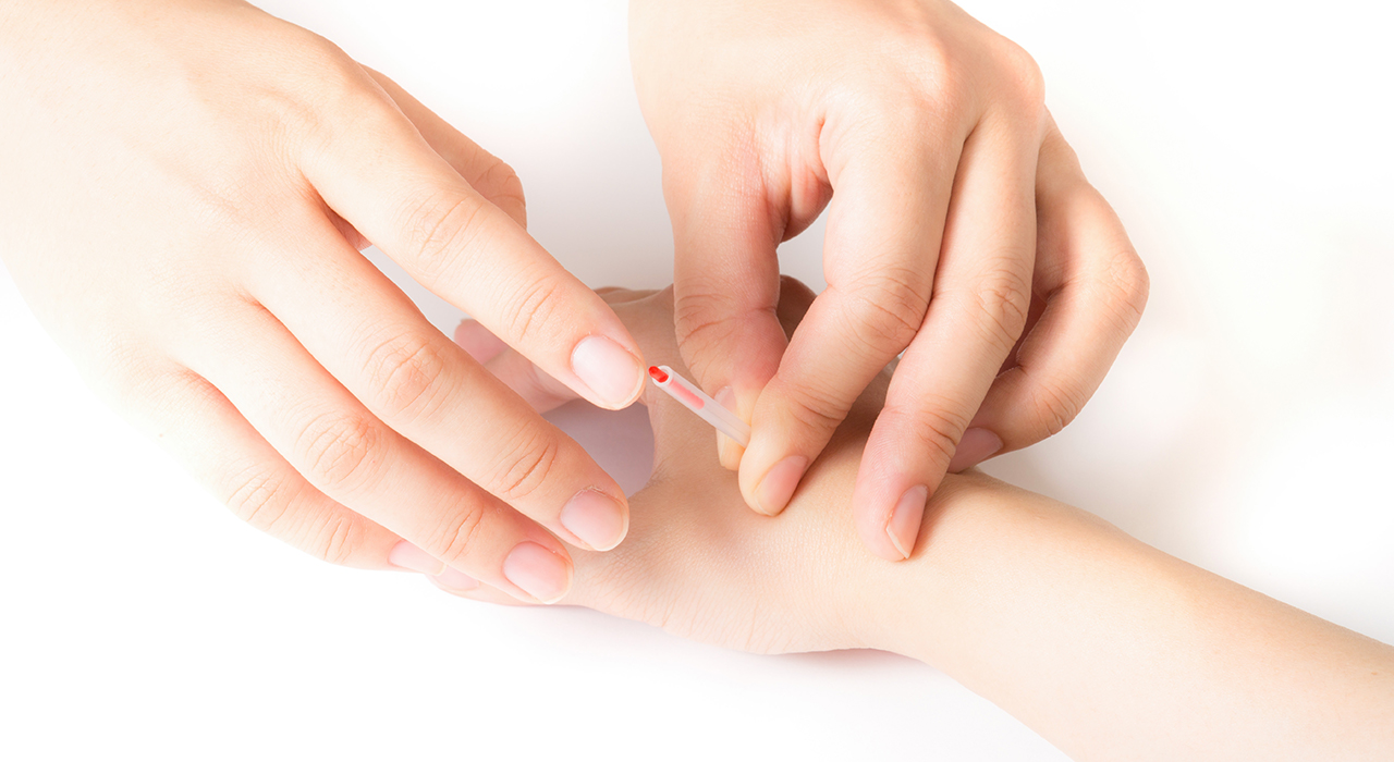 鍼灸師に手に針を打ってもらう女性